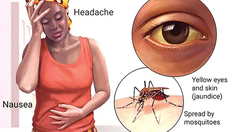 Lassa fever detected in Ghana