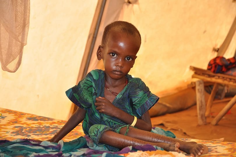 Malnutrition on the rise in Ghana